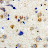 KCHIP1 Rabbit Polyclonal Antibody