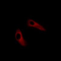 KCHIP1 Rabbit Polyclonal Antibody