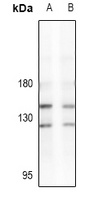 LATS2 Rabbit Polyclonal Antibody