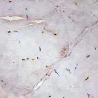 LATS2 Rabbit Polyclonal Antibody