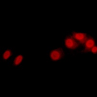 LATS2 Rabbit Polyclonal Antibody