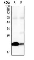 Claudin 4 Rabbit Polyclonal Antibody