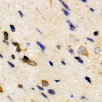 Claudin 4 Rabbit Polyclonal Antibody