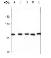 Kv2.1 Rabbit Polyclonal Antibody
