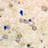 Kv2.1 Rabbit Polyclonal Antibody