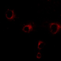 Kv2.1 Rabbit Polyclonal Antibody