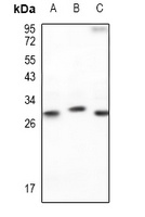 p27 Kip1 Rabbit Polyclonal Antibody