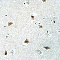p27 Kip1 Rabbit Polyclonal Antibody