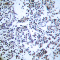 Caspase 3 Rabbit Polyclonal Antibody