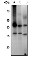 Aquaporin 2 (Phospho-S256) Rabbit Polyclonal Antibody