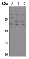 p53 Rabbit Polyclonal Antibody