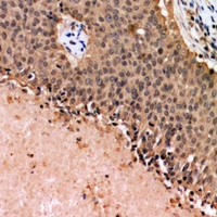 p53 Rabbit Polyclonal Antibody