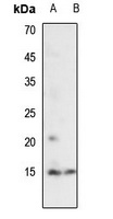 Histone H2A (Acetyl-K7) Rabbit Polyclonal Antibody