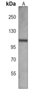 ECT2 Mouse Monoclonal Antibody