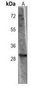OR5B12 Mouse Monoclonal Antibody