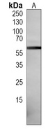 Histone Deacetylase 2 Mouse Monoclonal Antibody
