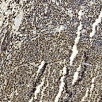 EZH2 Mouse Monoclonal Antibody
