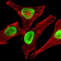 EZH2 Mouse Monoclonal Antibody