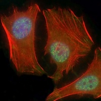 SMAD1 Mouse Monoclonal Antibody