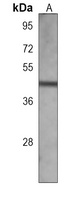 IHH Mouse Monoclonal Antibody