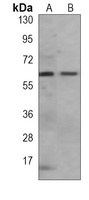 p62 Mouse Monoclonal Antibody