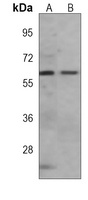 AMPK alpha 1 Mouse Monoclonal Antibody