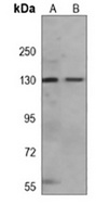SCAP Mouse Monoclonal Antibody