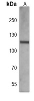 CD167a Mouse Monoclonal Antibody
