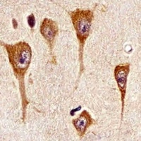 CD167a Mouse Monoclonal Antibody