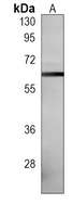 MDM2 Mouse Monoclonal Antibody