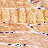 CDK5 Mouse Monoclonal Antibody