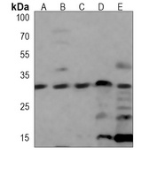 CDK5 Mouse Monoclonal Antibody
