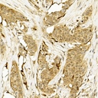 CDK5 Mouse Monoclonal Antibody