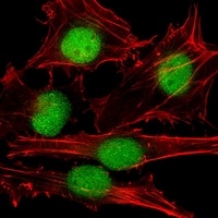 SUMO1 Mouse Monoclonal Antibody