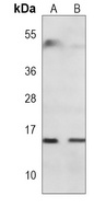 Rbx1 Mouse Monoclonal Antibody