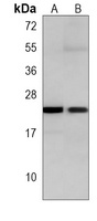 RRAS2 Mouse Monoclonal Antibody