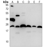 BID Mouse Monoclonal Antibody