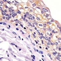 BID Mouse Monoclonal Antibody