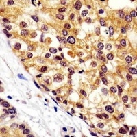 VCP Antibody