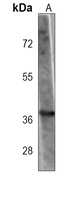 GBX2 Mouse Monoclonal Antibody