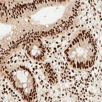 MSH2 Antibody [KO/KD Validated]