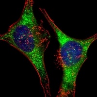 GlyRS Mouse Monoclonal Antibody