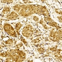 STAT3 Mouse Monoclonal Antibody