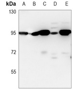 Beta-catenin Mouse Monoclonal Antibody