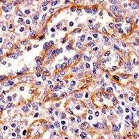 PPP2R1B Mouse Monoclonal Antibody