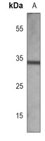 EPHB2 Mouse Monoclonal Antibody