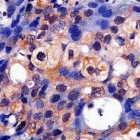 ERK1 Mouse Monoclonal Antibody