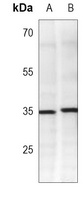 IKB alpha Mouse Monoclonal Antibody