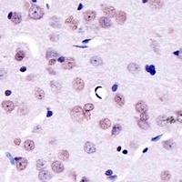 YY1 Mouse Monoclonal Antibody