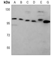 MCM3 Mouse Monoclonal Antibody